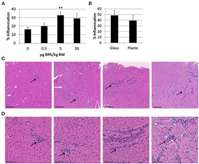 BPA Alters Estrogen Receptor Expression in the Heart After Viral Infection Activating Cardiac Mast Cells and T Cells Leading to Perimyocarditis and Fibrosis